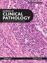 Journal of Clinical Pathology: 65 (11)