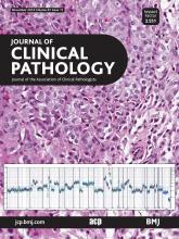 Journal of Clinical Pathology: 67 (11)