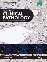 Journal of Clinical Pathology: 68 (11)