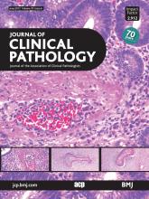Journal of Clinical Pathology: 70 (6)