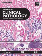Journal of Clinical Pathology: 72 (5)