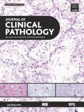 Journal of Clinical Pathology: 74 (6)