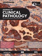 Journal of Clinical Pathology: 75 (3)