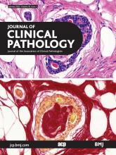 Journal of Clinical Pathology: 76 (1)